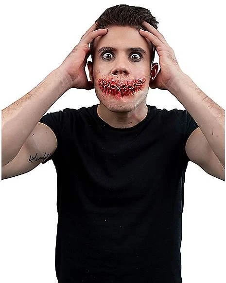 Sewn Mouth Appliance 1 Sewn Mouth Appliance